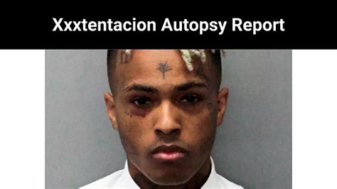 xxx tentacion autopsy|XXXTentacion’s Alleged Autopsy Report Surfaces Online